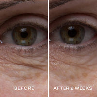 ELEMIS Peptide4 Eye Recovery Cream, Reviving Eye Cream, 0.5 Fl Oz