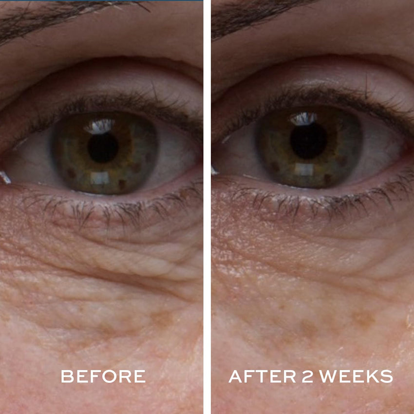 ELEMIS Peptide4 Eye Recovery Cream, Reviving Eye Cream, 0.5 Fl Oz