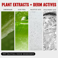 Thayers Blemish Clearing Salicylic Acid Toner, Acne Treatment Face Toner with 2% Salicylic Acid, Soothing and Non-Stripping Skin Care, 12 Fl Oz