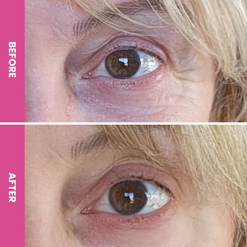 PRIME PROMETICS PrimeEyes Hydrate Under Eye Cream for Mature Women – Hydrating Eye Cream for Dark Circles and Wrinkle Repair – Soft, Glowing & Healthy Under Eyes