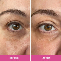 PRIME PROMETICS PrimeEyes Hydrate Under Eye Cream for Mature Women – Hydrating Eye Cream for Dark Circles and Wrinkle Repair – Soft, Glowing & Healthy Under Eyes