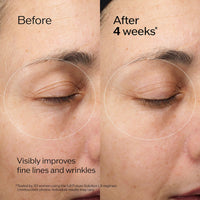 Shiseido Future Solution LX Eye and Lip Contour Regenerating Cream - 17 mL - Visibly Improves the Look of Wrinkles & Sagging Around the Eyes and Mouth - All Skin Types