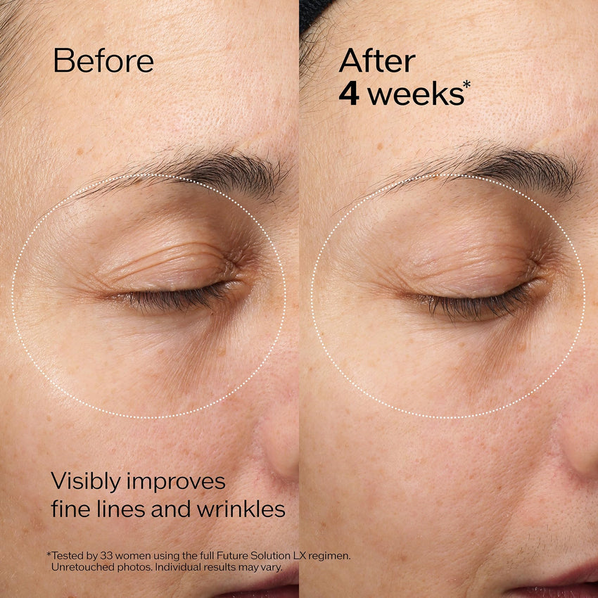 Shiseido Future Solution LX Eye and Lip Contour Regenerating Cream - 17 mL - Visibly Improves the Look of Wrinkles & Sagging Around the Eyes and Mouth - All Skin Types