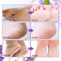 ALIVER Foot Peel Mask 3 Pack, Exfoliator Peel Off Calluses Dead Skin Callus Remover, Baby Soft Smooth Touch Feet - Men Women (Lavender) - 7DAY'S