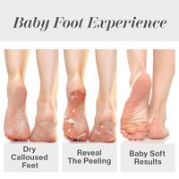 Baby Foot Original Exfoliation Foot Peel - Callus Remover for Rough Cracked, Dry Feet, Dead Skin Removal - Foot Peeling Mask for Baby Soft Feet - Spa Experience at Home & Gift Ideas - Lavender Scented - 7DAY'S