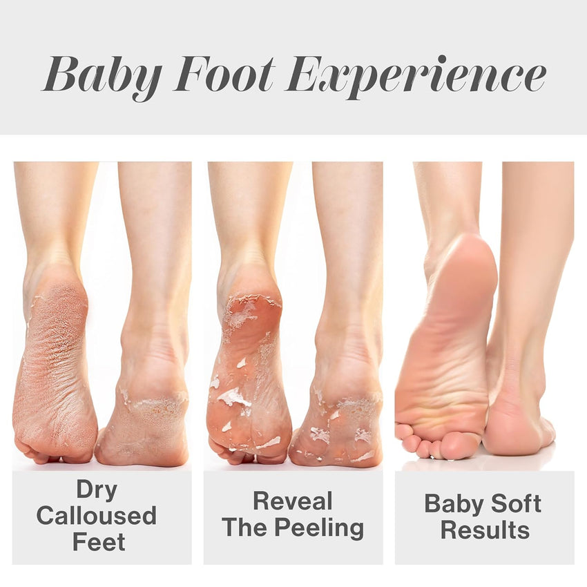 Baby Foot Original Exfoliation Foot Peel - Callus Remover for Rough Cracked, Dry Feet, Dead Skin Removal - Foot Peeling Mask for Baby Soft Feet - Spa Experience at Home & Gift Ideas - Lavender Scented - 7DAY'S