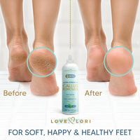 Callus Remover for Feet (Extra Strength) Foot Callus Remover Gel - Feet Scrubber, Pedicure Spa Tools, 6oz - 7DAY'S