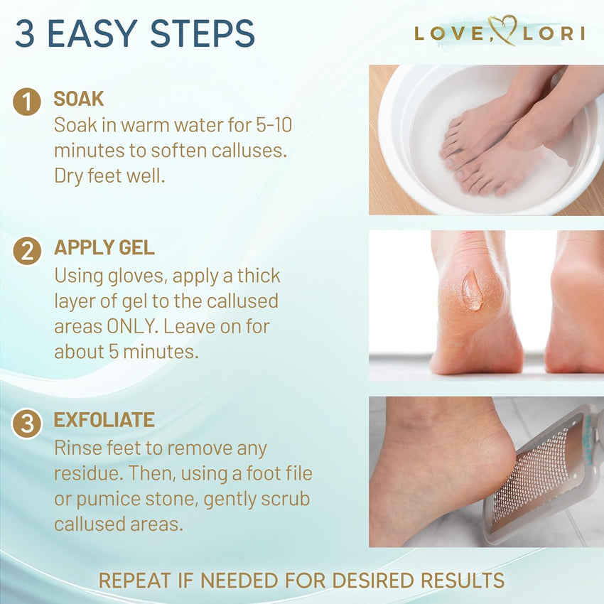 Callus Remover for Feet (Extra Strength) Foot Callus Remover Gel - Feet Scrubber, Pedicure Spa Tools, 6oz - 7DAY'S