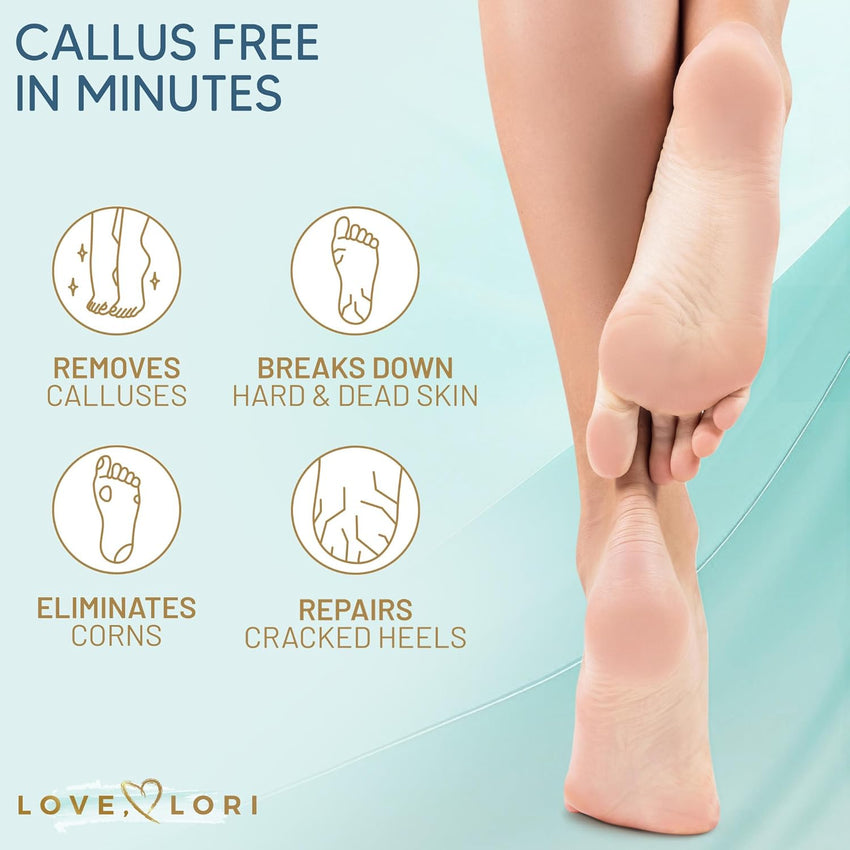 Callus Remover for Feet (Extra Strength) Foot Callus Remover Gel - Feet Scrubber, Pedicure Spa Tools, 6oz - 7DAY'S
