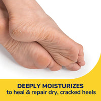 Dr. Scholl's Severe Cracked Heel Repair Restoring Balm 2.5oz, with 25% Urea for Dry, Cracked Feet, Heals and Moisturizes for Healthy Feet - 7DAY'S