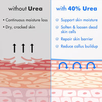 Ebanel Urea Cream 40% plus Salicylic Acid 2%, Foot Cream for Dry Cracked Heels Feet Knees Elbows Hands, Foot Dead Skin Cuticle Callus Remover Toenail Softener, Keratolytic Skin Barrier Repair - 7DAY'S