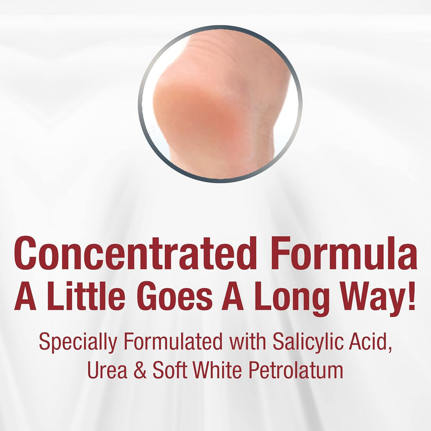 Kerasal Intensive Foot Repair, Skin Healing Ointment for Cracked Heels and Dry Feet, 1 Oz - 7DAY'S