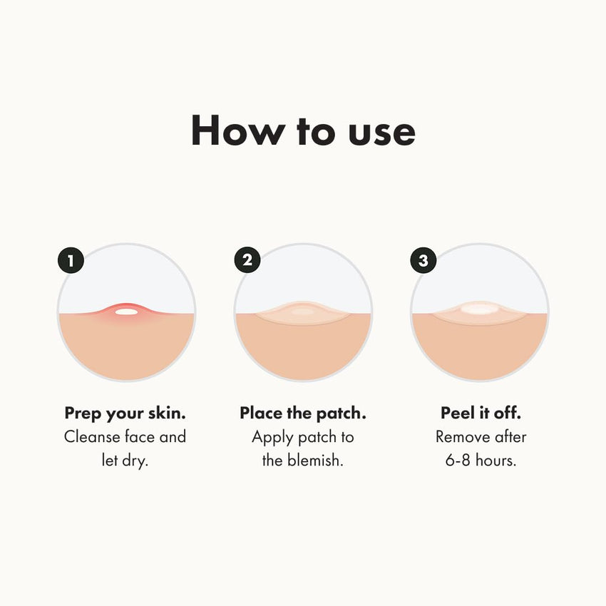 Mighty Patch™ Original patch from Hero Cosmetics – The 1 Hydrocolloid Acne Pimple Patch for Shrinking Zits and Whiteheads in 1 use; Nighttime Spot Stickers for Face and Skin (36 Count) - 7DAY'S