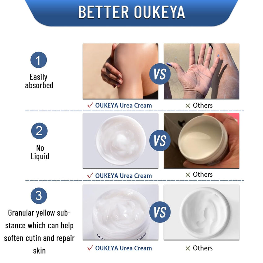 OUKEYA Urea Cream 40 Percent,Foot & Hand Cream for Dry Cracked,Urea Lotion for Feet Maximum Strength - 7DAY'S