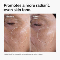 The Ordinary Glycolic Acid 7% Exfoliating Toner, Brightening and Smoothing Daily Toner for More Even - Looking Skin Tone - 7DAY'S