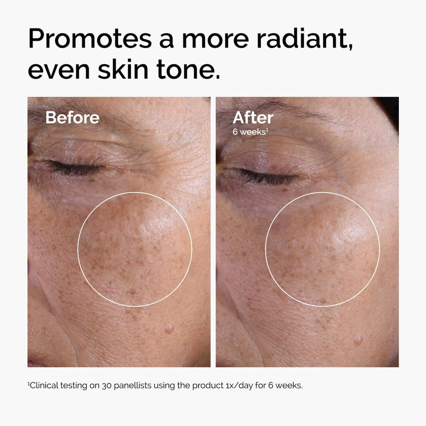 The Ordinary Glycolic Acid 7% Exfoliating Toner, Brightening and Smoothing Daily Toner for More Even - Looking Skin Tone - 7DAY'S