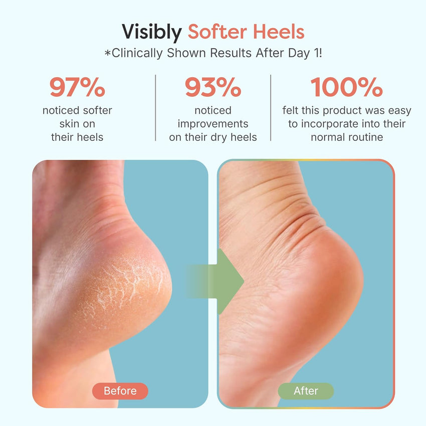 ZenToes Moisturizing Socks for Cracked Heel Treatment - Vitamin E, Olive Oil and Jojoba Oil Infused Heel Socks to Soften and Hydrate (Fuzzy Blue, Regular) - 7DAY'S
