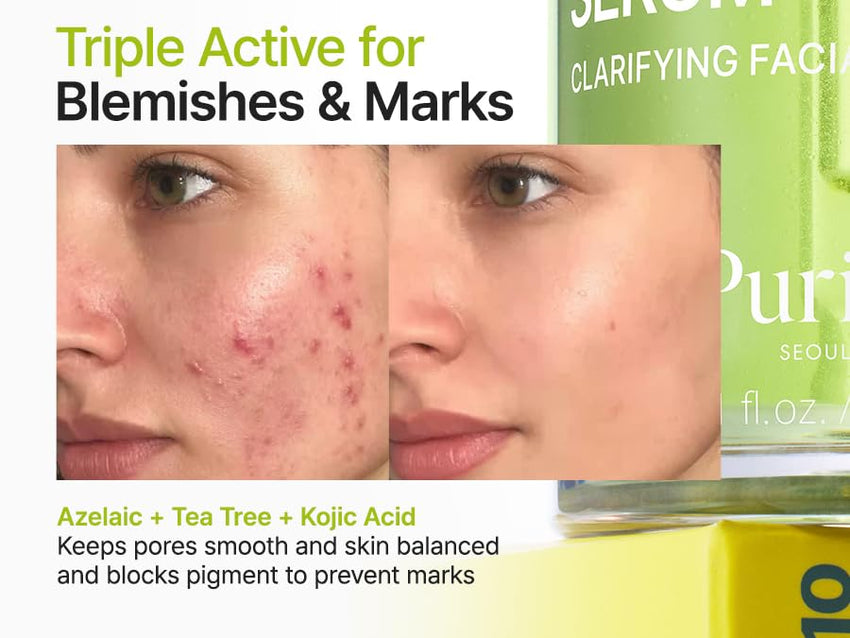 PURITO Azelaic Acid 10% + Kojic Acid + Tea Tree Facial Serum | for Acne & Marks, Breakouts | High-Level Azelaic Acid 10% | Korean skincare, 30mL 1.01 fl.oz