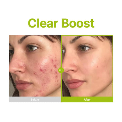 PURITO Azelaic Acid 10% + Kojic Acid + Tea Tree Facial Serum | for Acne & Marks, Breakouts | High-Level Azelaic Acid 10% | Korean skincare, 30mL 1.01 fl.oz