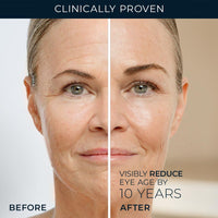 RoC Retinol Correxion Under Eye Cream for Dark Circles & Puffiness, Daily Wrinkle Cream, Anti Aging Skin Care Treatment Women and Men, 1 oz (Packaging May Vary)