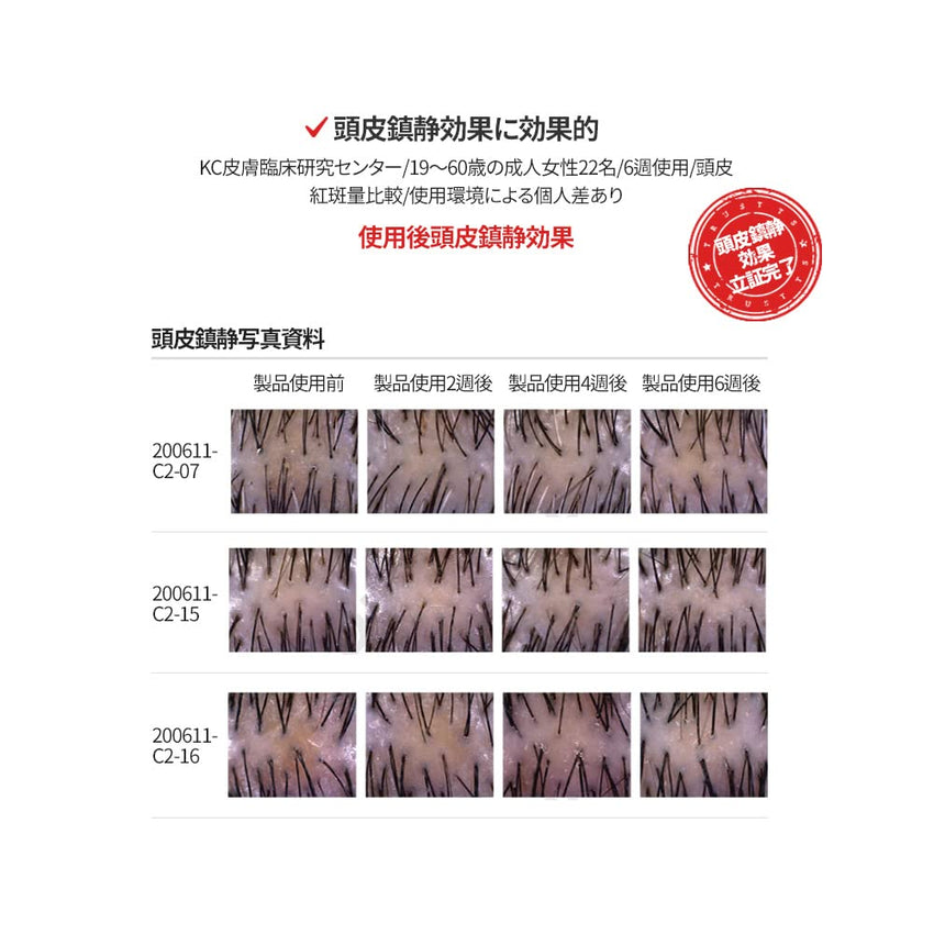 TS Gold Plus Shampoo | Hair Loss Shampoo with Biotin, Gold Extract & Niacinamide | Scalp Circulation & Volume Care | Sulfate-Free Korean Hair Care for Thinning Hair (17.6 Fl Oz / 500mL)