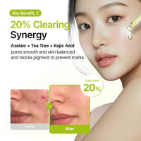 PURITO Azelaic Acid 10% + Kojic Acid + Tea Tree Facial Serum | for Acne & Marks, Breakouts | High-Level Azelaic Acid 10% | Korean skincare, 30mL 1.01 fl.oz
