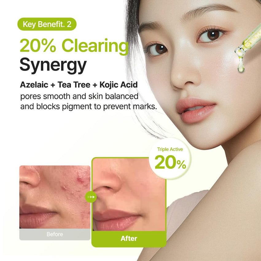 PURITO Azelaic Acid 10% + Kojic Acid + Tea Tree Facial Serum | for Acne & Marks, Breakouts | High-Level Azelaic Acid 10% | Korean skincare, 30mL 1.01 fl.oz