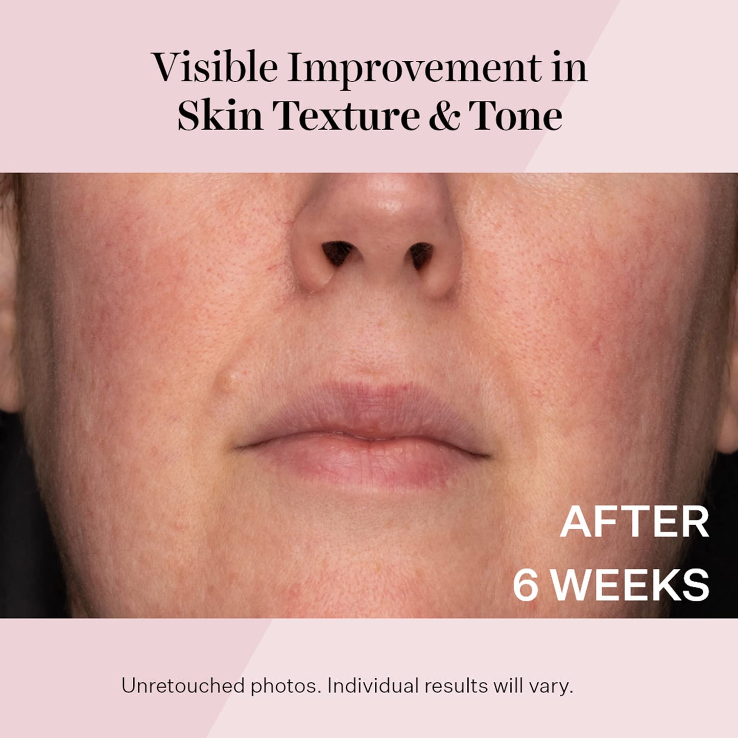 StriVectin Advanced Retinol Intensive Night Moisturizer, Targets Visible Signs of Aging for Healthier Skin, 1.7 Fl Oz