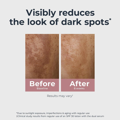 Eucerin Radiant Tone Dual Serum Dark Spot Corrector, Dark Spot Serum with Thiamidol and Hyaluronic Acid, Helps Visibly Reduce the Look of Persistent Dark Spots, 1 Fl Oz Bottle