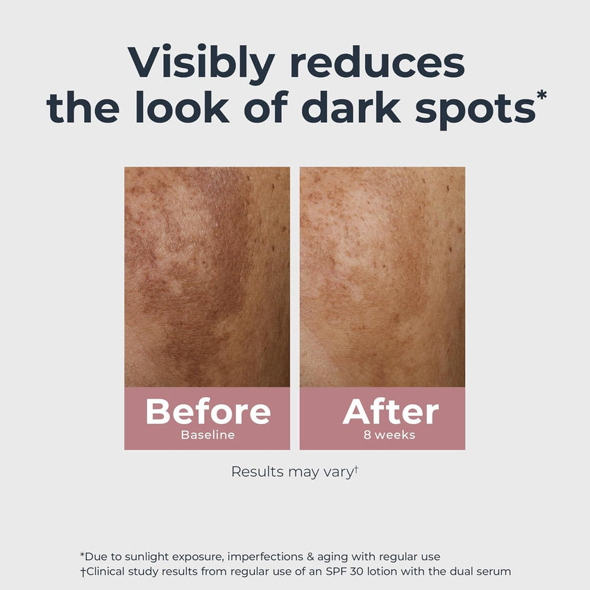 Eucerin Radiant Tone Dual Serum Dark Spot Corrector, Dark Spot Serum with Thiamidol and Hyaluronic Acid, Helps Visibly Reduce the Look of Persistent Dark Spots, 1 Fl Oz Bottle