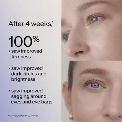 Shiseido Vital Perfection Uplifting and Firming Advanced Eye Cream - 15 mL - Improve Under-Eye Bags, Wrinkles & Dark Circles - Includes Exclusive Massage Roller Tool