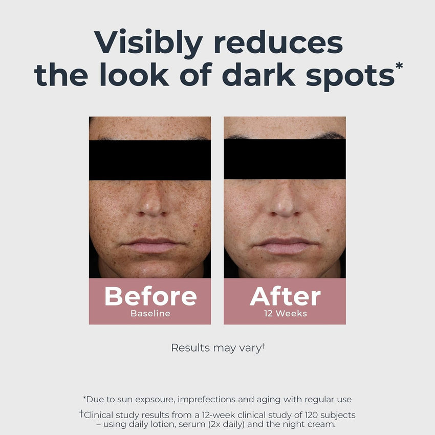 Eucerin Radiant Tone Dual Serum Dark Spot Corrector, Dark Spot Serum with Thiamidol and Hyaluronic Acid, Helps Visibly Reduce the Look of Persistent Dark Spots, 1 Fl Oz Bottle