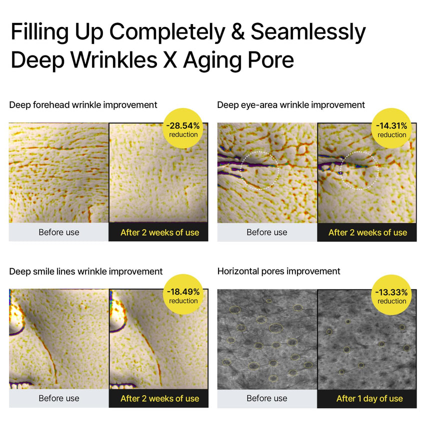 celimax The Vita A Retinal Shot Tightening Booster | 0.1% Retinal, 3% Matryxyl, High-Strength Retinoid for Anti-Aging, Pore Minimizer, Wrinkles & Fine Lines, Firmer Skin, 15ml