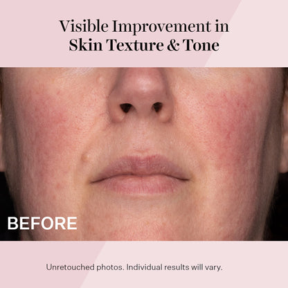 StriVectin Advanced Retinol Intensive Night Moisturizer, Targets Visible Signs of Aging for Healthier Skin, 1.7 Fl Oz