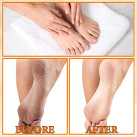 1PCS Foot Peeling Spray Orange Oil,Exfoliating Foot Spray for Remove Dead Skin,Hydrating Foot Care Spray,Peel Off Spray for Calluses & Dry Toe Cracked Rough,Quickly Moisturizing & Nourishing Feet