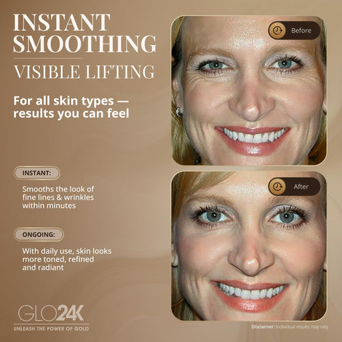 GLO24K Instant Wrinkle Filler for Face, XL Lifting Cream for Eye and Face, Lift and Tightening Non-Invasive with Hyaluronic Acid, 24k Gold, Peptides and Vitamins for Youthful Appearance, 1.2 fl oz