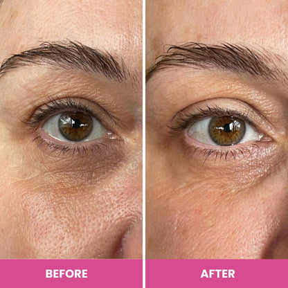 PRIME PROMETICS PrimeEyes Hydrate Under Eye Cream for Mature Women – Hydrating Eye Cream for Dark Circles and Wrinkle Repair – Soft, Glowing & Healthy Under Eyes