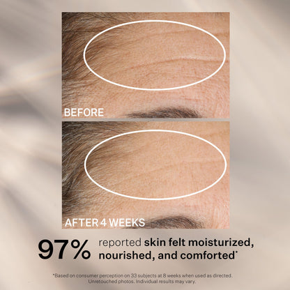 StriVectin Advanced Retinol Intensive Night Moisturizer, Targets Visible Signs of Aging for Healthier Skin, 1.7 Fl Oz