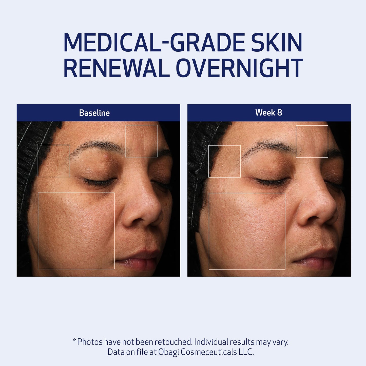 Obagi Medical Retinol + PHA Refining Night Cream - Clinically Proven, Dual-Action, Overnight Anti-Aging Face Cream for Smoother, Renewed Skin & a More Even-Looking Complexion - 1.7 Oz