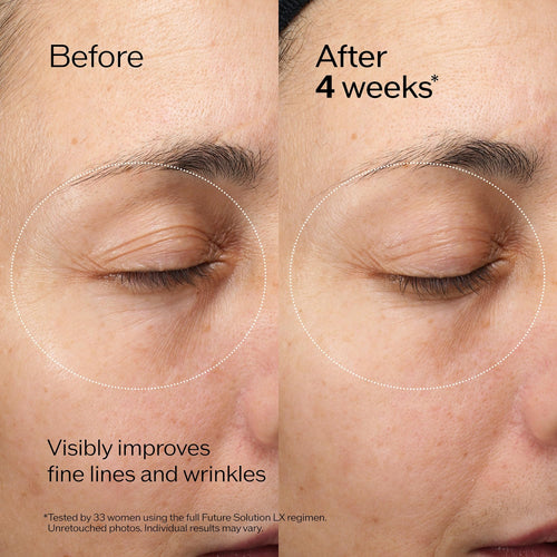 Shiseido Future Solution LX Eye and Lip Contour Regenerating Cream - 17 mL - Visibly Improves the Look of Wrinkles & Sagging Around the Eyes and Mouth - All Skin Types