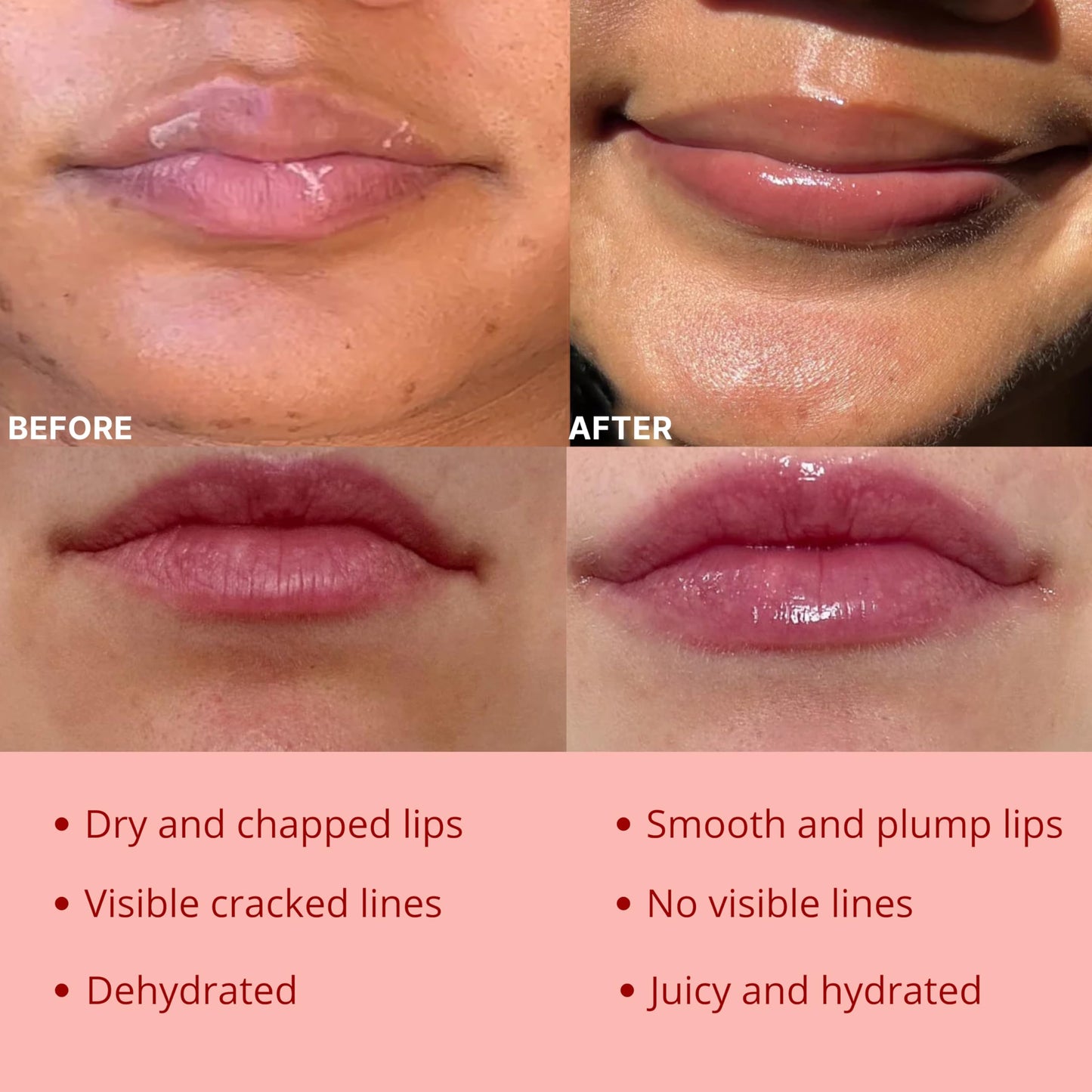 Original My Bee Balm Lip Balm - 2 pack Hydrating Balm Honey Pot for Dry, Chapped & Cracked Lips - Enriched with Propolis, Honey & Vitamin E - Soften, Smooth & Reduce Lip Lines