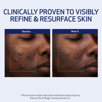 Obagi Medical Retinol + PHA Refining Night Cream - Clinically Proven, Dual-Action, Overnight Anti-Aging Face Cream for Smoother, Renewed Skin & a More Even-Looking Complexion - 1.7 Oz