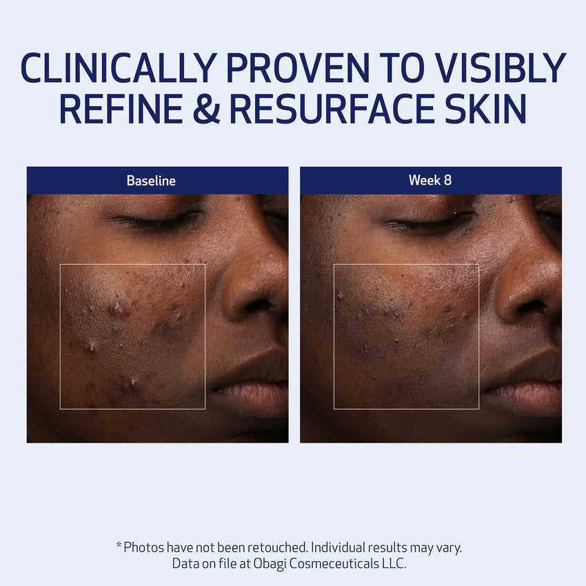 Obagi Medical Retinol + PHA Refining Night Cream - Clinically Proven, Dual-Action, Overnight Anti-Aging Face Cream for Smoother, Renewed Skin & a More Even-Looking Complexion - 1.7 Oz