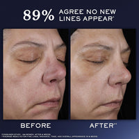 Lancôme Génifique Ultimate Dual Recovery Face Serum- Anti-Aging Serum Visibly Improves Fine Lines, Rough Texture, Plumpness and Even Skintone - with Beta Glucan and, Hyaluronic Acid