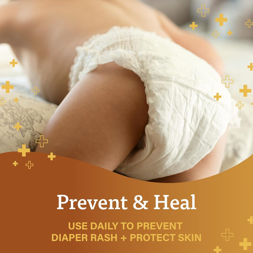 A+D Original Diaper Rash Ointment Prevents & Treats Diaper Rash, Moisturizing Skin Protectant with Vitamins A & D, Healing Skin Ointment for Dry and Cracked Skin 4oz - 7DAY'S