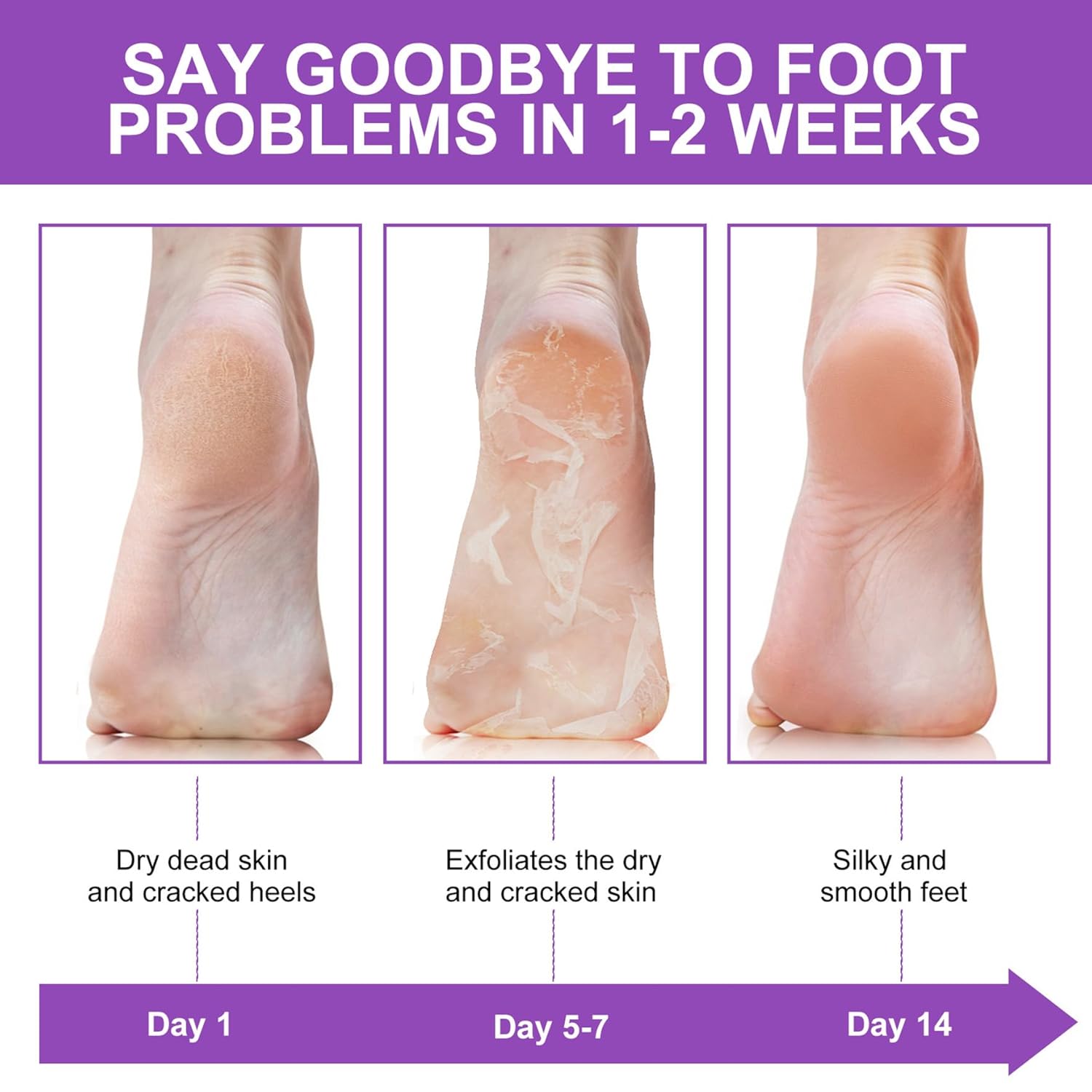 ALIVER Foot Peel Mask 3 Pack, Exfoliator Peel Off Calluses Dead Skin Callus Remover, Baby Soft Smooth Touch Feet - Men Women (Lavender) - 7DAY'S