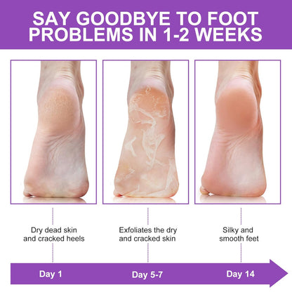 ALIVER Foot Peel Mask 3 Pack, Exfoliator Peel Off Calluses Dead Skin Callus Remover, Baby Soft Smooth Touch Feet - Men Women (Lavender) - 7DAY'S