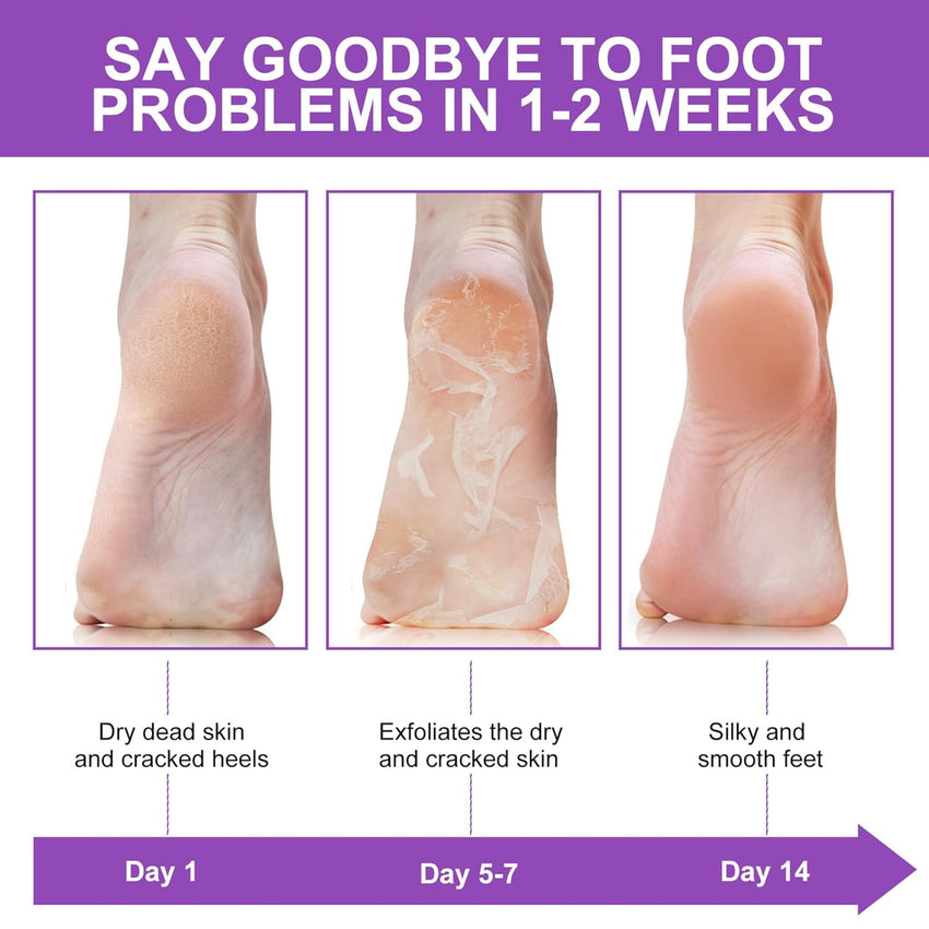 ALIVER Foot Peel Mask 3 Pack, Exfoliator Peel Off Calluses Dead Skin Callus Remover, Baby Soft Smooth Touch Feet - Men Women (Lavender) - 7DAY'S