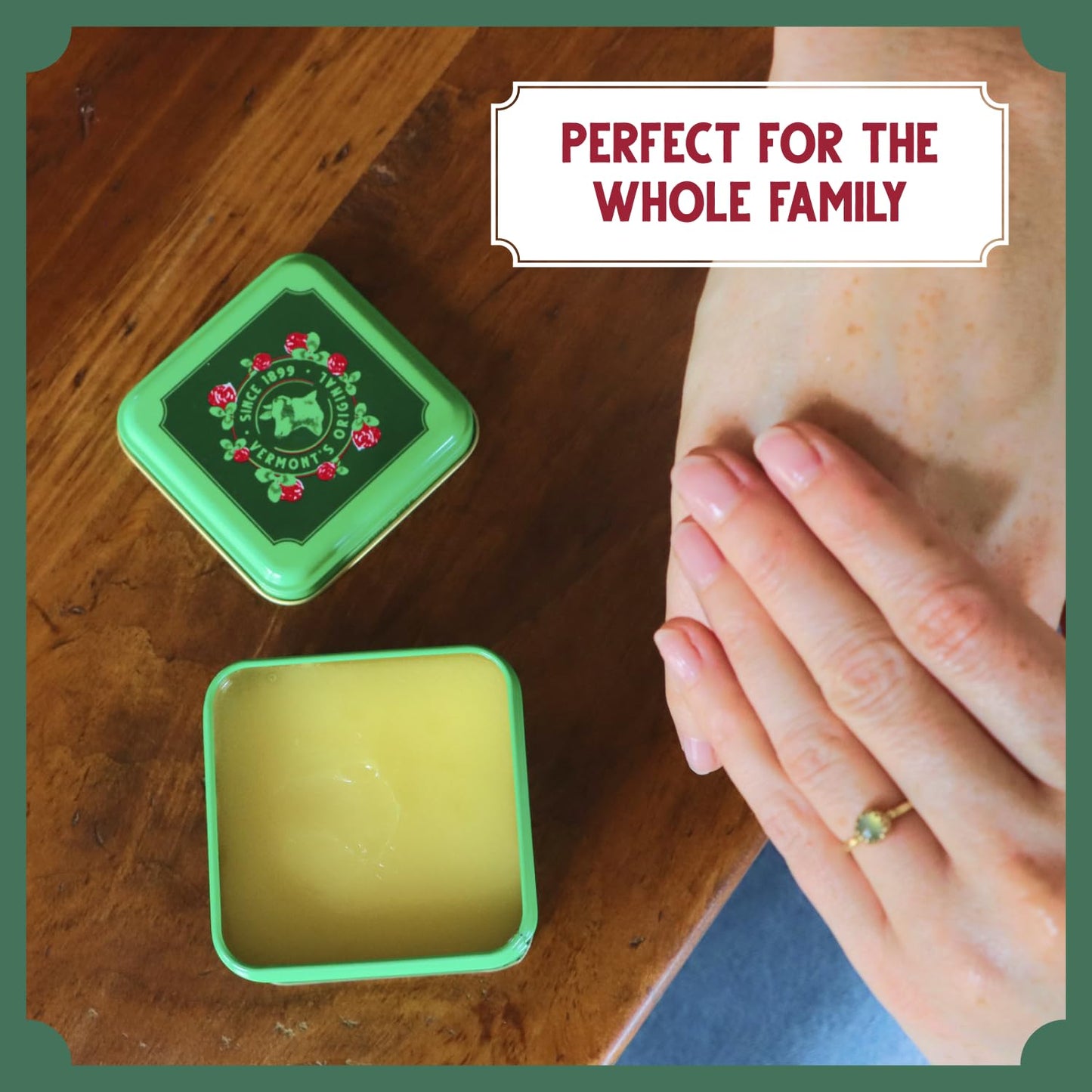 Bag Balm Vermont's Original Skin Moisturizer - Full Body Hydrating Skin Care: Dry Hands, Lips, Face, Feet & More - Unscented, Cruelty & Paraben Free - Day & Night, Men & Women (4oz Tin, Made in USA) - 7DAY'S