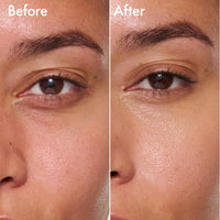 Catrice | Under Eye Brightener | Conceal & Brighten Dark Circles | With Hyaluronic Acid & Shea Butter | Vegan, Cruelty Free & Paraben Free (010 | Light Rose) - 7DAY'S